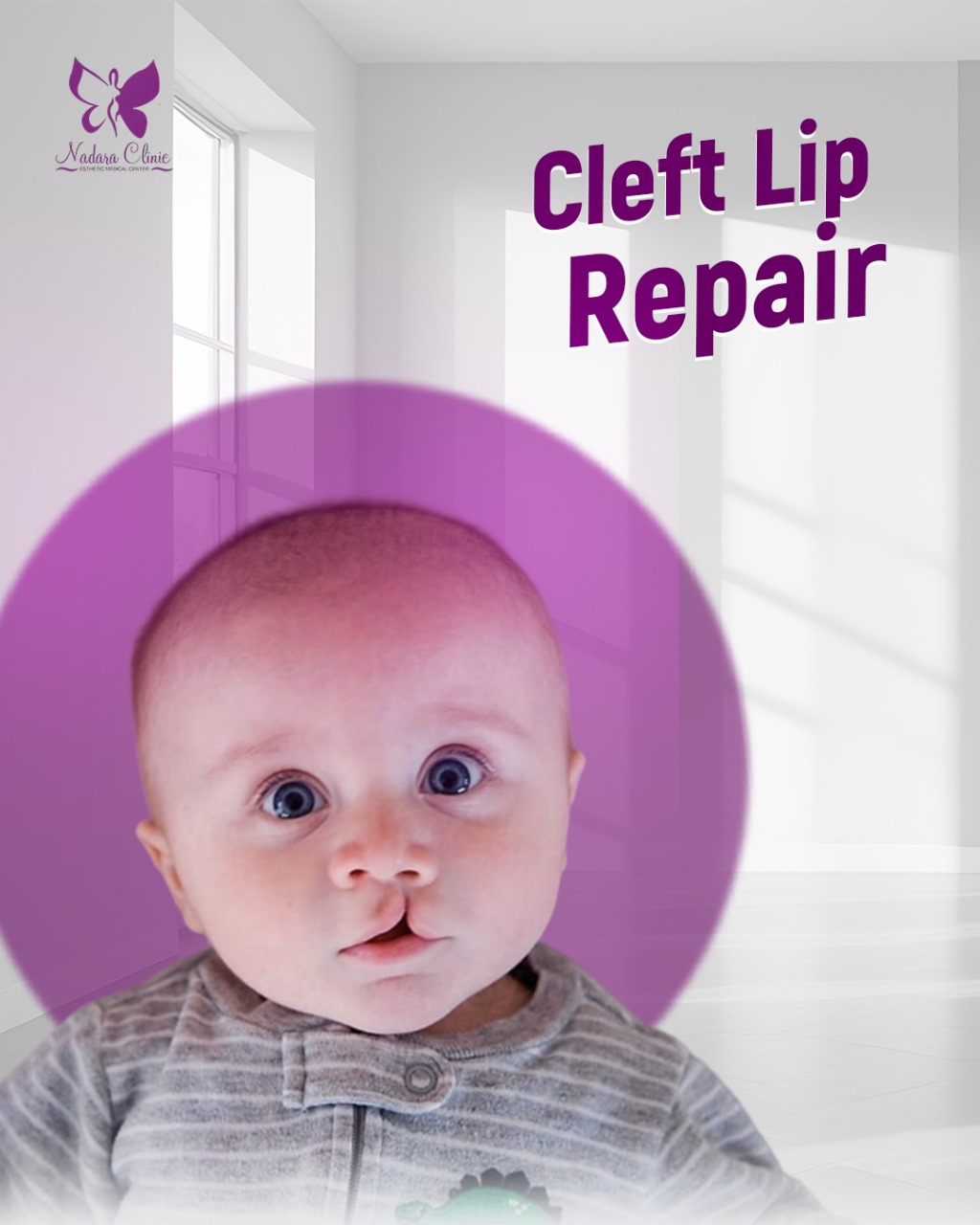 cleft lip